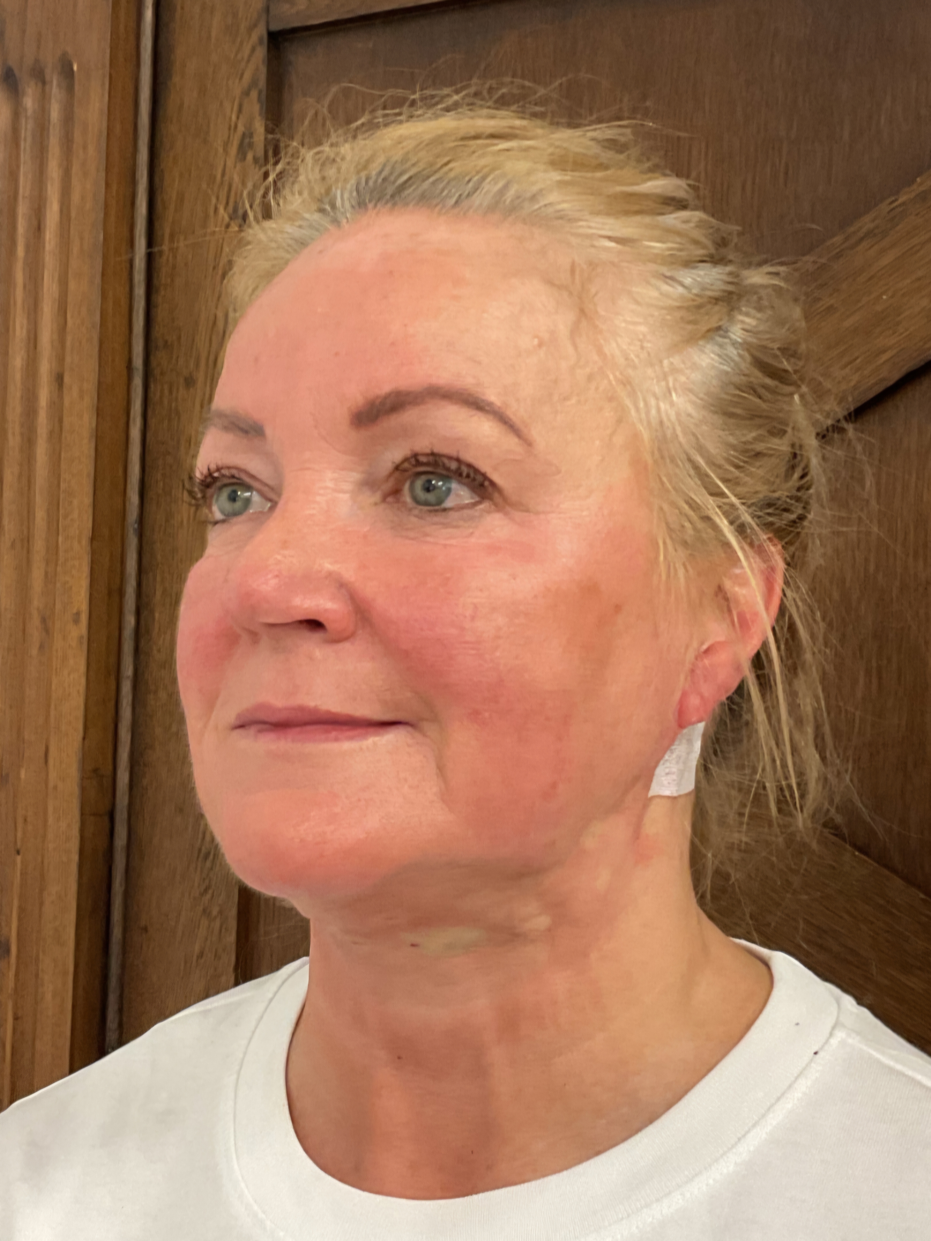 Treatment result
